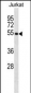 CREB3 Antibody (N-term)