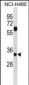 SDCBP Antibody (N-term)