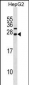 CDKN3 Antibody (N-term)