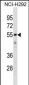 HNRNPH1 Antibody (N-term)