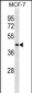 ILF2 Antibody (N-term)