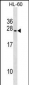 UBE2S Antibody (C-term)