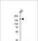 TSC2 Antibody (Center S1418/S1420)