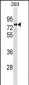 PARP6 Antibody (C-term)