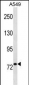 RRM1 Antibody (N-term)