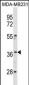 HOXC10 Antibody (C-term)