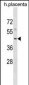 WIPI1 Antibody (N-term)