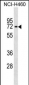 IL28RA Antibody (C-term)