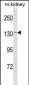 CASR Antibody (Center)