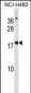 CSH1 Antibody (N-term)