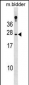 RBP4 Antibody (N-term)