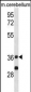 PPP2CA Antibody (Center)