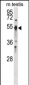 PTPN1 Antibody (Center)