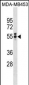 T Antibody (N-term)