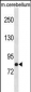 NSF Antibody (C-term)