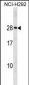 HLA-DQA2 Antibody (Center)