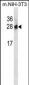 PSPH Antibody (N-term)