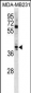 ATOH1 Antibody (C-term)