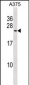 POLR2G Antibody (C-term)