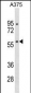 RBCK1 Antibody (N-term)
