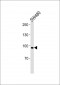 ANO6 Antibody (N-term)