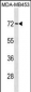 MEX3C Antibody (C-term)