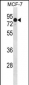 GATAD2A Antibody (N-term)