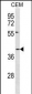 DARC Antibody (N-term)