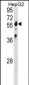 SPTLC2 Antibody (Center)