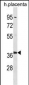 PSMD6 Antibody (Center)