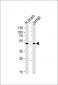 CHN1 Antibody (N-term)