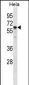 CCT7 Antibody (N-term)