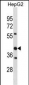 STOML2 Antibody (Center)