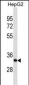 SFXN1 Antibody (C-term)
