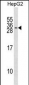 KCNMB2 Antibody (N-term)