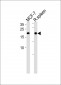 CNBP Antibody (Center)