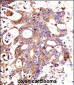 CTNNB1 Antibody (C-term)