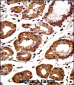 CTNNB1 Antibody (C-term)