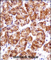 CTNNB1 Antibody (N-term)