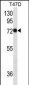 CD138 Antibody