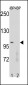 CTNNB1 Antibody (N-term)