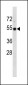 TP53 Antibody (Center)