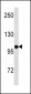 INSR Antibody (N-term)