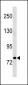 STAT3 Antibody (N-term)