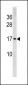 HIST1H3/2H3/3H3/H3F3 Antibody (N-term)