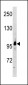 RUNDC2A Antibody (C-term)