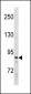 SUZ12 Antibody (C-term)