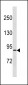 RPS6KA4 Antibody (Center)