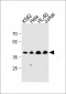 MECR Antibody (Center)