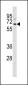TCF7L1 Antibody (N-term)